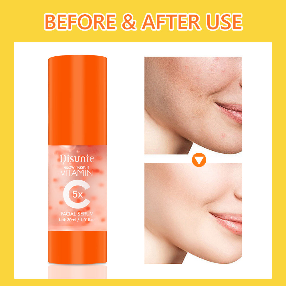 Vit C Face Serum Facial Whitening Brightening Hyaluronic Acid Collagen Vitamin C Dark Spot Corrector Anti-Aging Serum